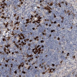 Anti-MASTL antibody produced in rabbit 