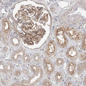 Anti-MAT2B antibody produced in rabbit HPA037721-100UL