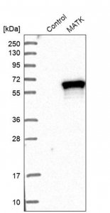 Anti-MATK antibody produced in rabbit 