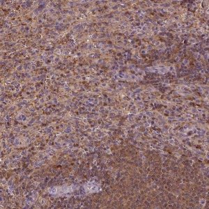 Anti-MATK antibody produced in rabbit 