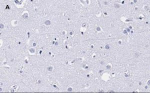 Anti-MBP Antibody, clone 2N6 , ZooMAb� Rabbit Monoclonal 