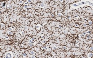 Anti-MBP Antibody, clone 2N6 , ZooMAb� Rabbit Monoclonal 