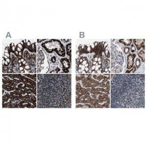 Anti-MDH2 antibody produced in rabbit 
