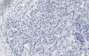 Anti-MDM2 Antibody, clone IF2 ZooMAb� Mouse Monoclonal 