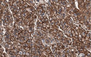 Anti-MDR-1 Antibody, clone 1O12 ZooMAb� Rabbit Monoclonal 