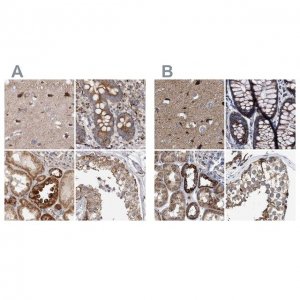 Anti-MECR antibody produced in rabbit HPA028740-100UL