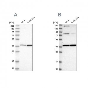 Anti-MECR antibody produced in rabbit HPA028740-100UL