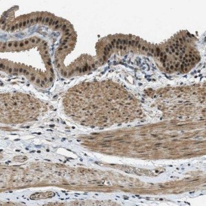 Anti-MED21 antibody produced in rabbit 
