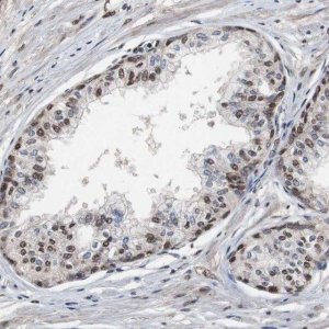Anti-MED27 antibody produced in rabbit HPA007002-100UL