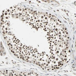 Anti-MED4 antibody produced in rabbit HPA006232-100UL