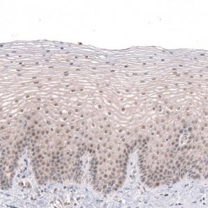 Anti-MGA antibody produced in rabbit 