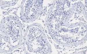 Anti-MGMT Antibody, clone 2N19 ZooMAb� Rabbit Monoclonal 