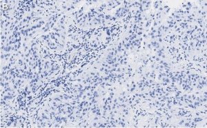 Anti-MICB Antibody, clone 2K9 ZooMAb� Rabbit Monoclonal 