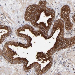Anti-MIPOL1 antibody produced in rabbit 