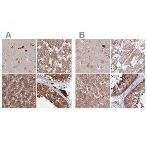 Anti-MKRN2 antibody produced in rabbit 