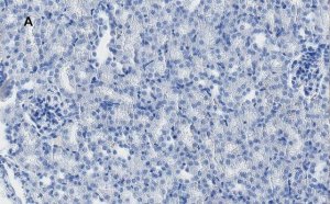 Anti-MLKL Antibody, clone 3F13, ZooMAb� Rabbit Monoclonal 