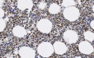 Anti-MMP-9 Antibody, clone 8H12 ZooMAb� Rabbit Monoclonal 