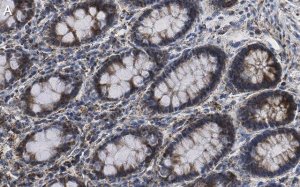 Anti-Mn-SOD Antibody, clone 1C14 ZooMAb� Rabbit Monoclonal 