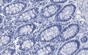 Anti-Mn-SOD Antibody, clone 1C14 ZooMAb� Rabbit Monoclonal 