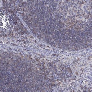 Anti-MND1 