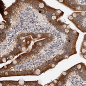 Anti-MOGAT2 antibody produced in rabbit 