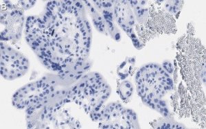 Anti-MR-proADM Antibody, clone 2B19 ZooMAb� Rabbit Monoclonal 