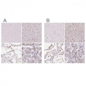 Anti-MRC1 antibody produced in rabbit 