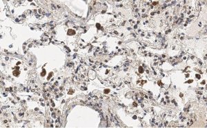 Anti-MRC1 Antibody, clone 1C9 ZooMAb� Rabbit Monoclonal 
