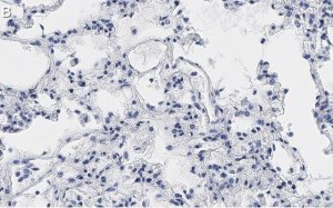 Anti-MRC1 Antibody, clone 1C9 ZooMAb� Rabbit Monoclonal 