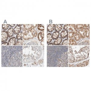 Anti-MRM3 antibody produced in rabbit 
