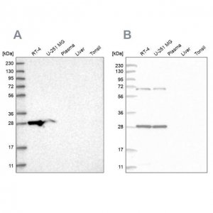 Anti-MRPL10 antibody produced in rabbit 
