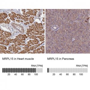 Anti-MRPL15 antibody produced in rabbit 