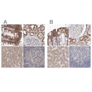Anti-MRPL18 antibody produced in rabbit 