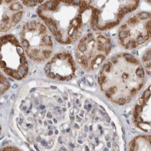 Anti-MRPL18 antibody produced in rabbit 