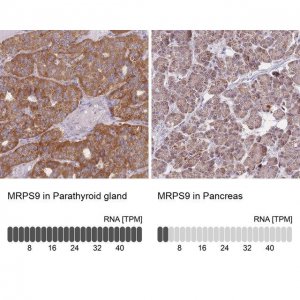 Anti-MRPS9 antibody produced in rabbit 