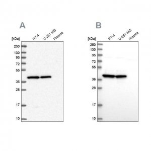 Anti-MRPS9 antibody produced in rabbit 