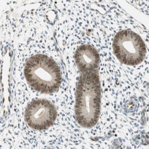 Anti-MSX2 antibody produced in rabbit 
