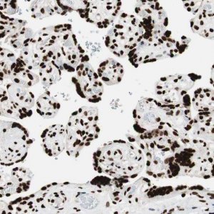 Anti-MTA2 antibody produced in rabbit 