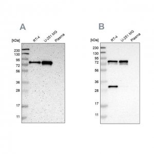 Anti-MTDH antibody produced in rabbit 