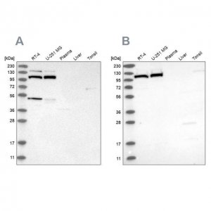 Anti-MTHFD1L antibody produced in rabbit 