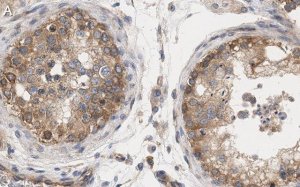 Anti-mTOR Antibody, clone 4O5 ZooMAb� Rabbit Monoclonal 