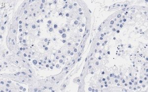 Anti-mTOR Antibody, clone 4O5 ZooMAb� Rabbit Monoclonal 
