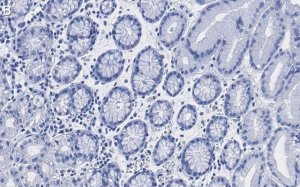 Anti-MUC1 Antibody, clone 1F23 ZooMAb� Rabbit Monoclonal 