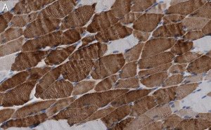 Anti-MYH1 Antibody, clone 1E15 , ZooMAb� Rabbit Monoclonal 