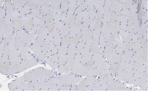 Anti-Myosin Heavy Chain 7 Antibody, clone 1B19, ZooMAb� Rabbit Monoclonal 