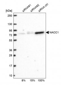 Anti-NACC1 antibody produced in rabbit HPA062245-100UL