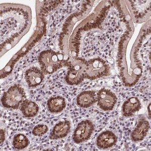 Anti-NACC1 antibody produced in rabbit HPA062245-100UL