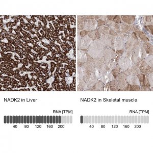 Anti-NADK2 antibody produced in rabbit 