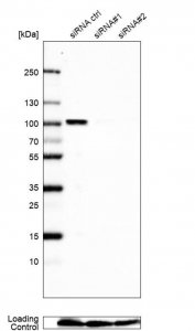 Anti-NCAPH2 antibody produced in rabbit 