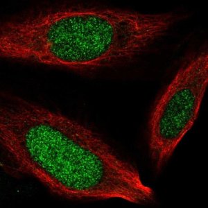 Anti-NCAPH2 antibody produced in rabbit 
